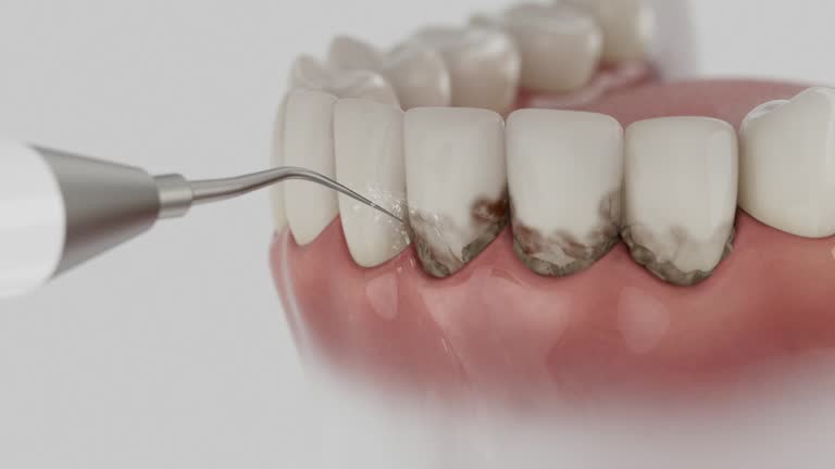 Trusted Root Canal Treatment service in Bellefonte, PA - Dentist Open Now